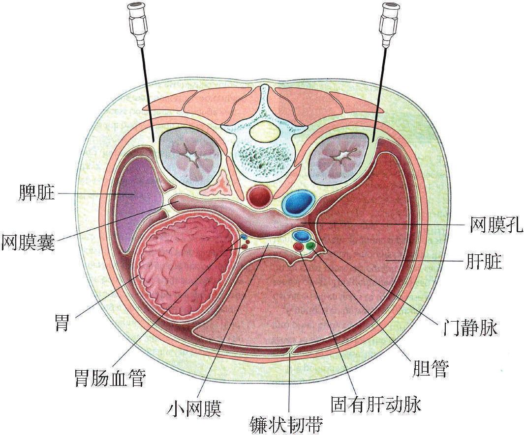 第十二節(jié) 腎周圍脂肪囊注射療法